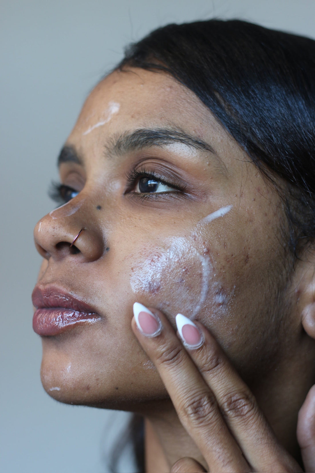 Dark Spots and PCOS: Why Hormonal Skin Needs a Different Approach to Hyperpigmentation