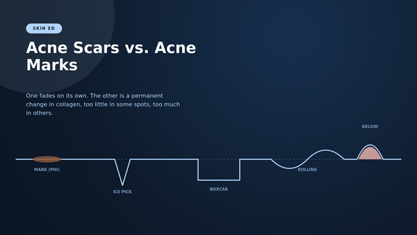 Acne Scars vs. Acne Marks: What's Actually Fixable at Home