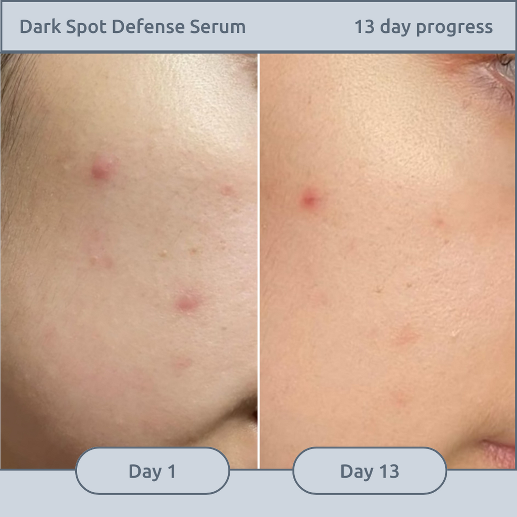 Dark Spot Defense Serum