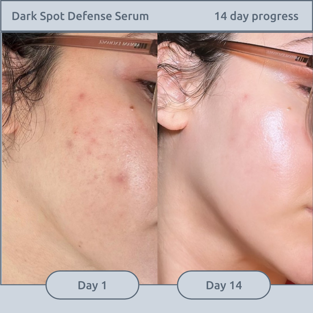 Dark Spot Defense Serum