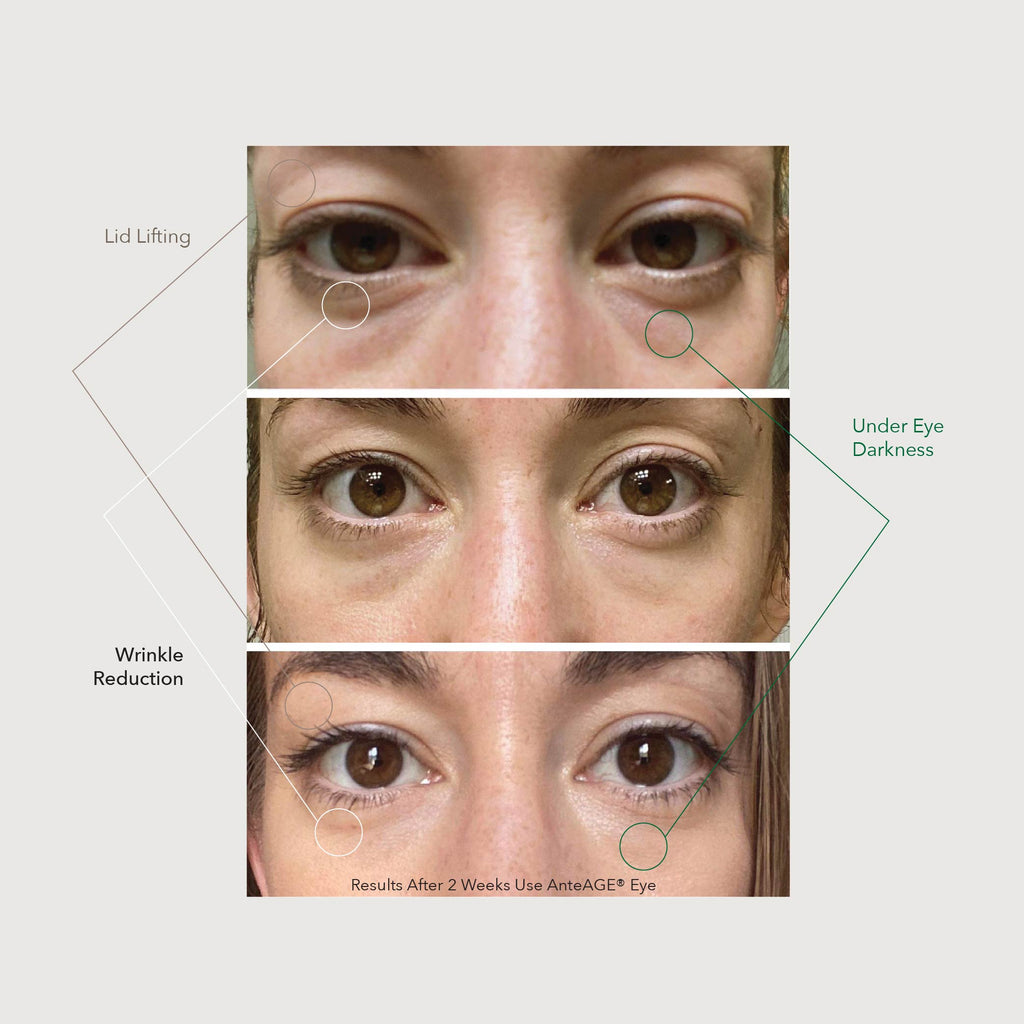 Anteage Eye Cream